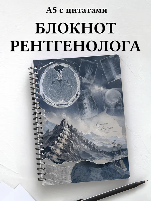 Блокнот рентгенолога