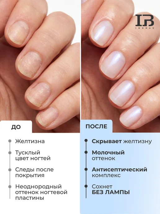INBEAU Антифунгал лечебный лак для ногтей противогрибковый, белый, фото 2