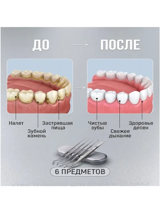 Премиум стоматологический набор инструментов для гигиены рта, вариант, фото 6