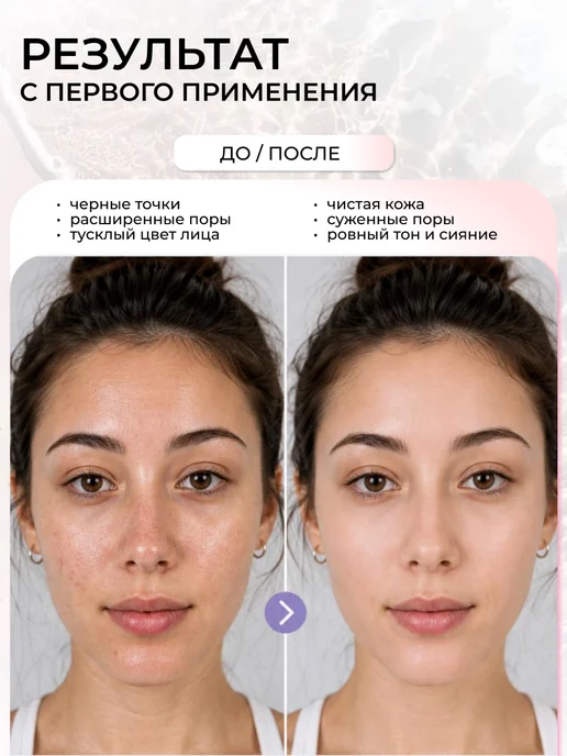 glow ritual Щетка для лица силиконовая 2 в 1 и спонжик для умывания, вариант, фото 6