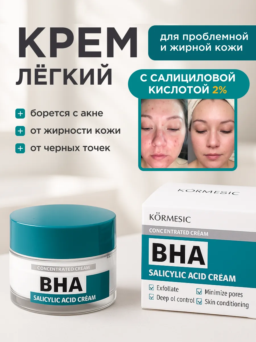 Крем от прыщей