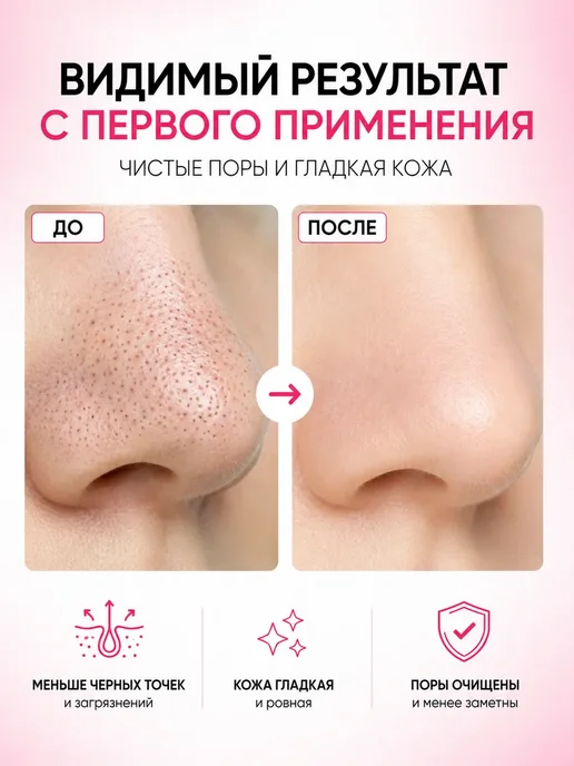 PrettyGirl Очищающие полоски для носа от черных точек 10 шт, 10 шт, фото 3