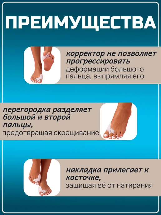 Разделитель для пальцев ног силиконовый бурсопротектор, белый, фото 3