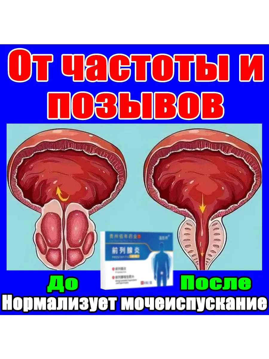 Бесплатные фотографии сильного мочеиспускания доступны вам в любое время дня и ночи Бесплатные фотографии сильного мочеиспускания доступны вам в любое время дня и ночи