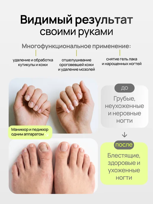 Аппарат для маникюра и педикюра, белый, фото 2