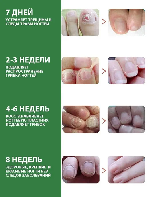 Продукты для ухода за ногтями, фиолетовый, фото 3